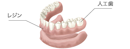 レジン 人口歯