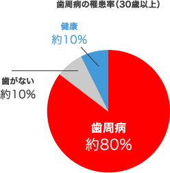 歯周病の罹患率（30歳以上）健康 約10% 歯がない 約10% 歯周病 約80%